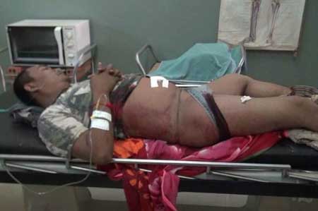 ​បុរស​ម្នាក់​ជា​យោធា​មាន​ស្រី​ស្នេហ៍ ប្រពន្ធ​តាម​ទាន់​បាញ់​ចំនួន ៣ គ្រាប់​ស្លាប់​ពេល​សំរាក​ព្យាបាល​